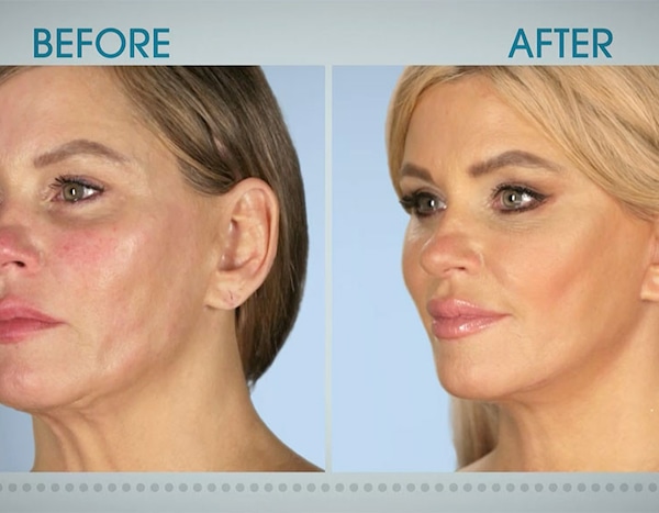 Her Neck Is a Wreck from Botched Patients Before and After: Shocking Transformations! | E! News